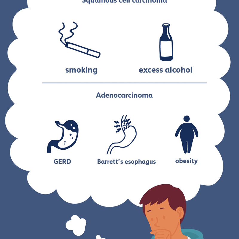 Orsaker och riskfaktorer för esophageal cancer / cancer