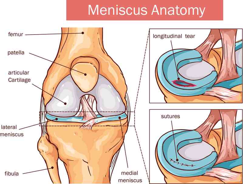 Totul despre artrita genunchiului - Simptome, tipuri, tratament | ejocurigratis.ro