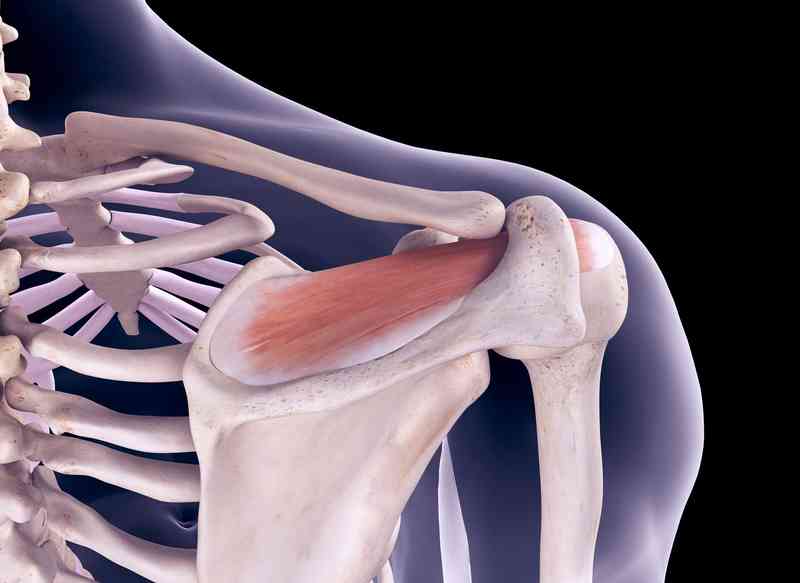 Deteriorarea tendoanelor manșetei de rotație a articulației umărului,