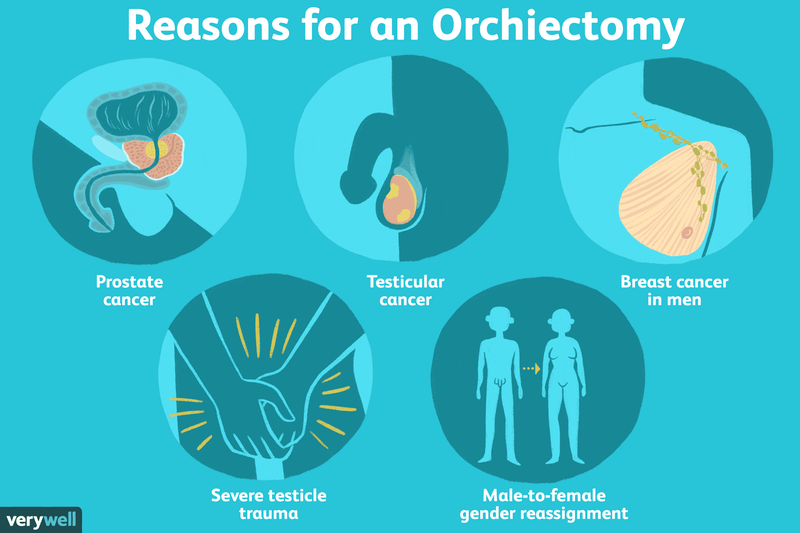 erecție cu orhiectomie)